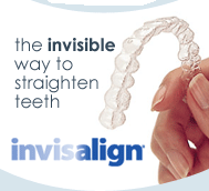 the invisible way to straighten teeth invisalign