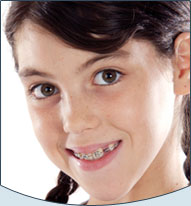 smiling girl with braces